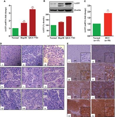 AATF inhibition exerts antiangiogenic effects against human hepatocellular carcinoma